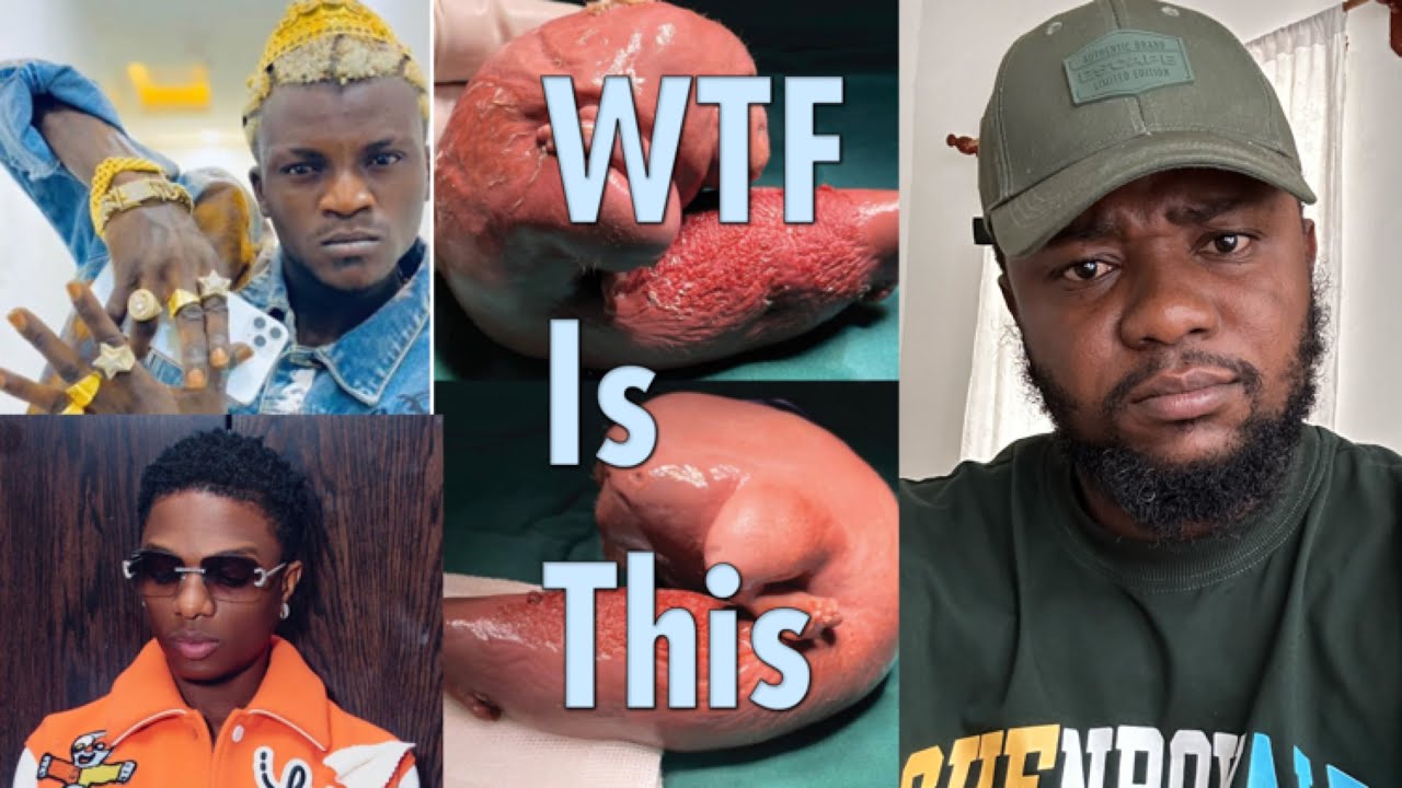 Why Portable Insulted Wizkid… Real Live Jesus Christ